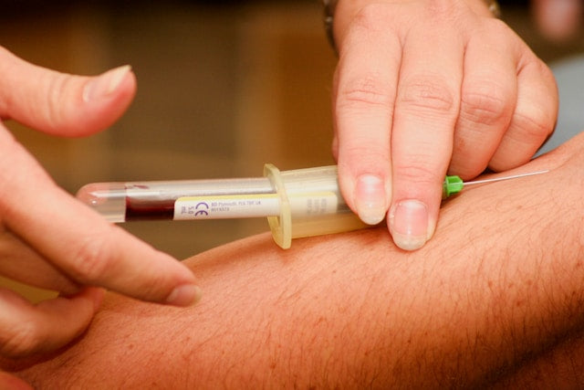 What Foods Increase Blood Flow: Top Nutrients and Choices